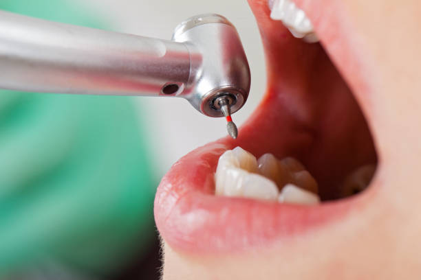 Best Pediatric Emergency Dentist in Chesterfield, SC
